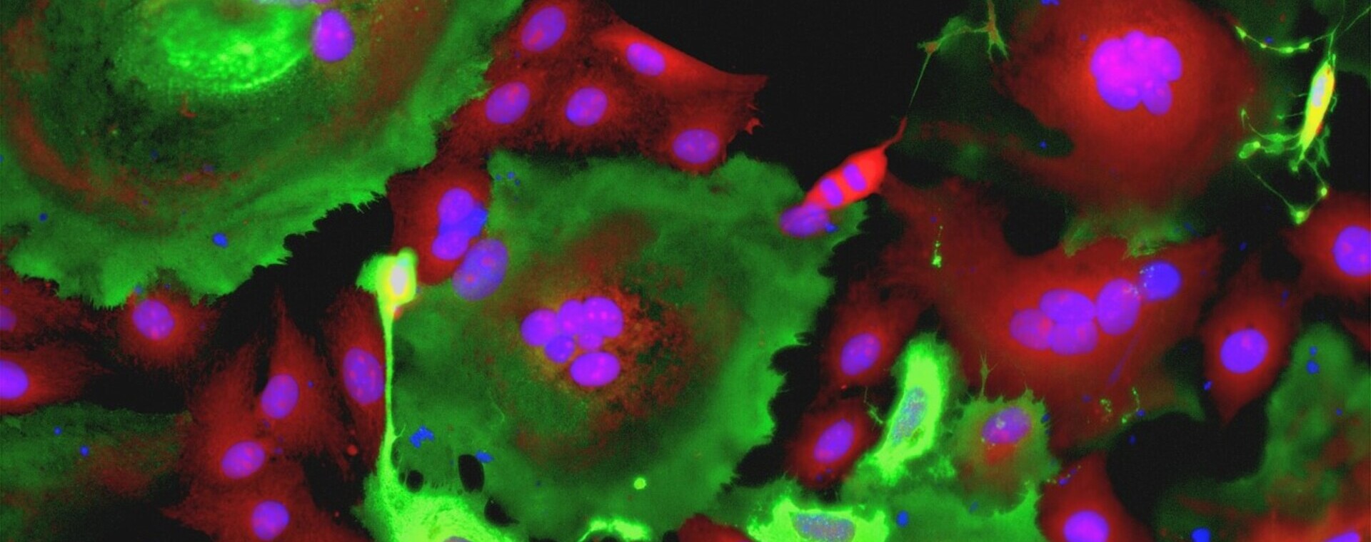 An anti-parasite drug is able to block lung damage caused by COVID-19